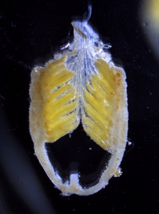 Ovarioles from Melanoplus pellucida